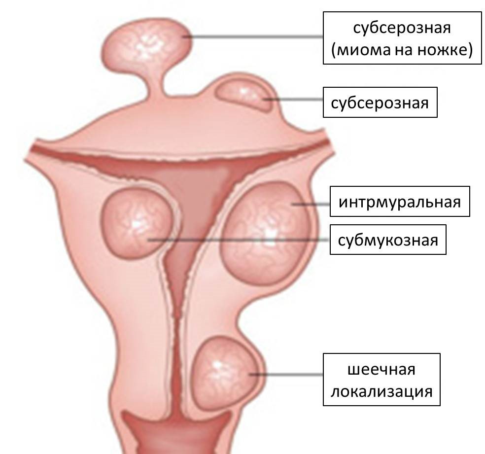 Болезнь печени признаки фибромы